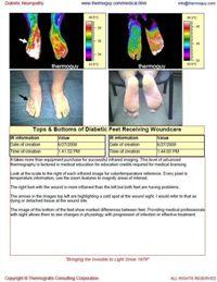 Tops and Bottoms of Diabetic Feet Receiving Wound Care