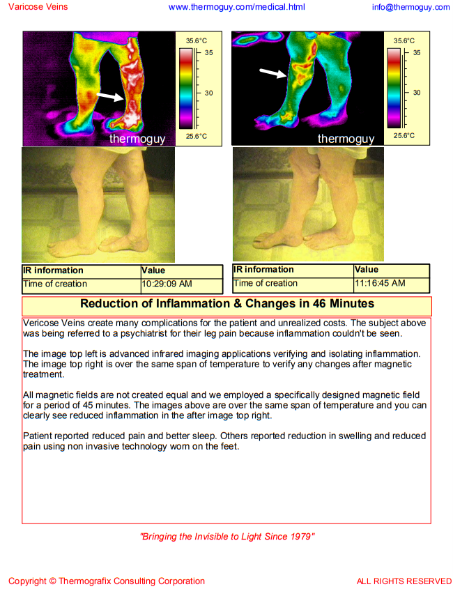 Reduction Inflammation Changes 46 Minutes