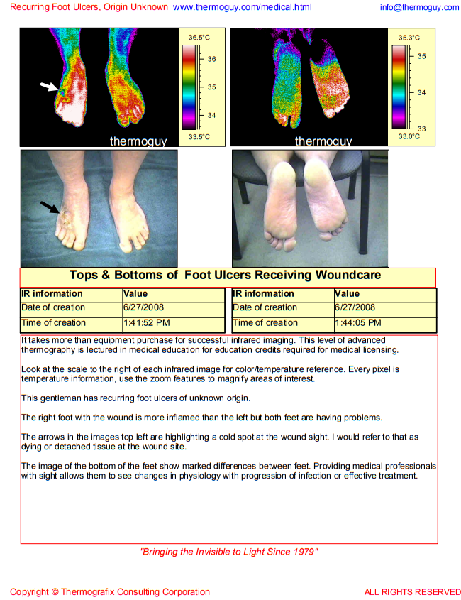 Tops and Bottoms of Diabetic Feet Receiving Wound Care