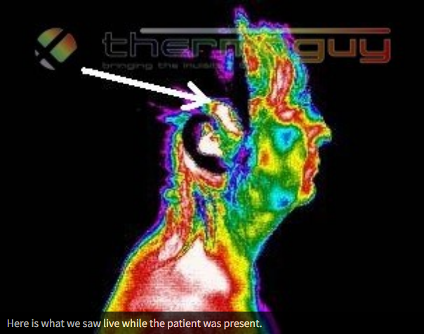 Here is what we saw live while the patient was present.