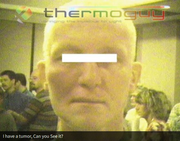 I have a tumour. Can you See it?