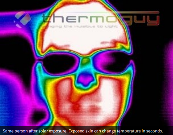Same person after solar exposure. Exposed skin can change temperature in seconds.