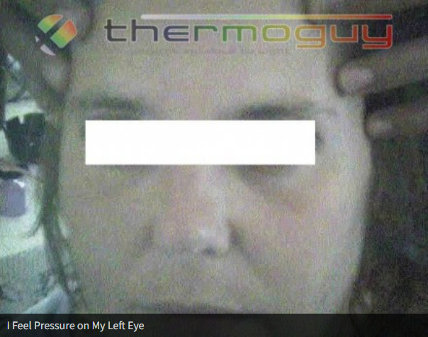 I Feel Pressure on My Left Eye