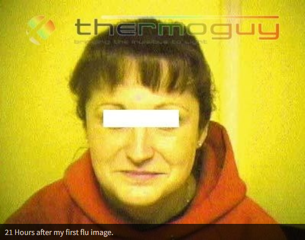 21 Hours after my first flu image.