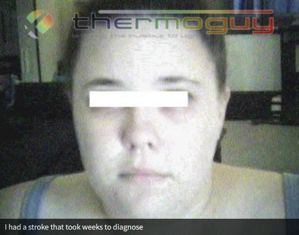 I had a stroke that took weeks to diagnose.