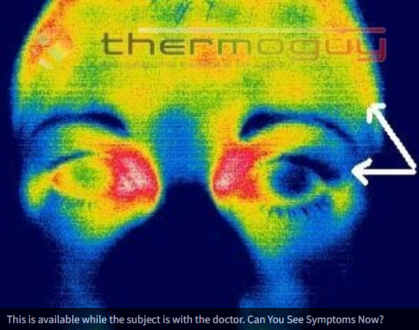 This is available while the subject is with the doctor. Can You See Symptoms Now?