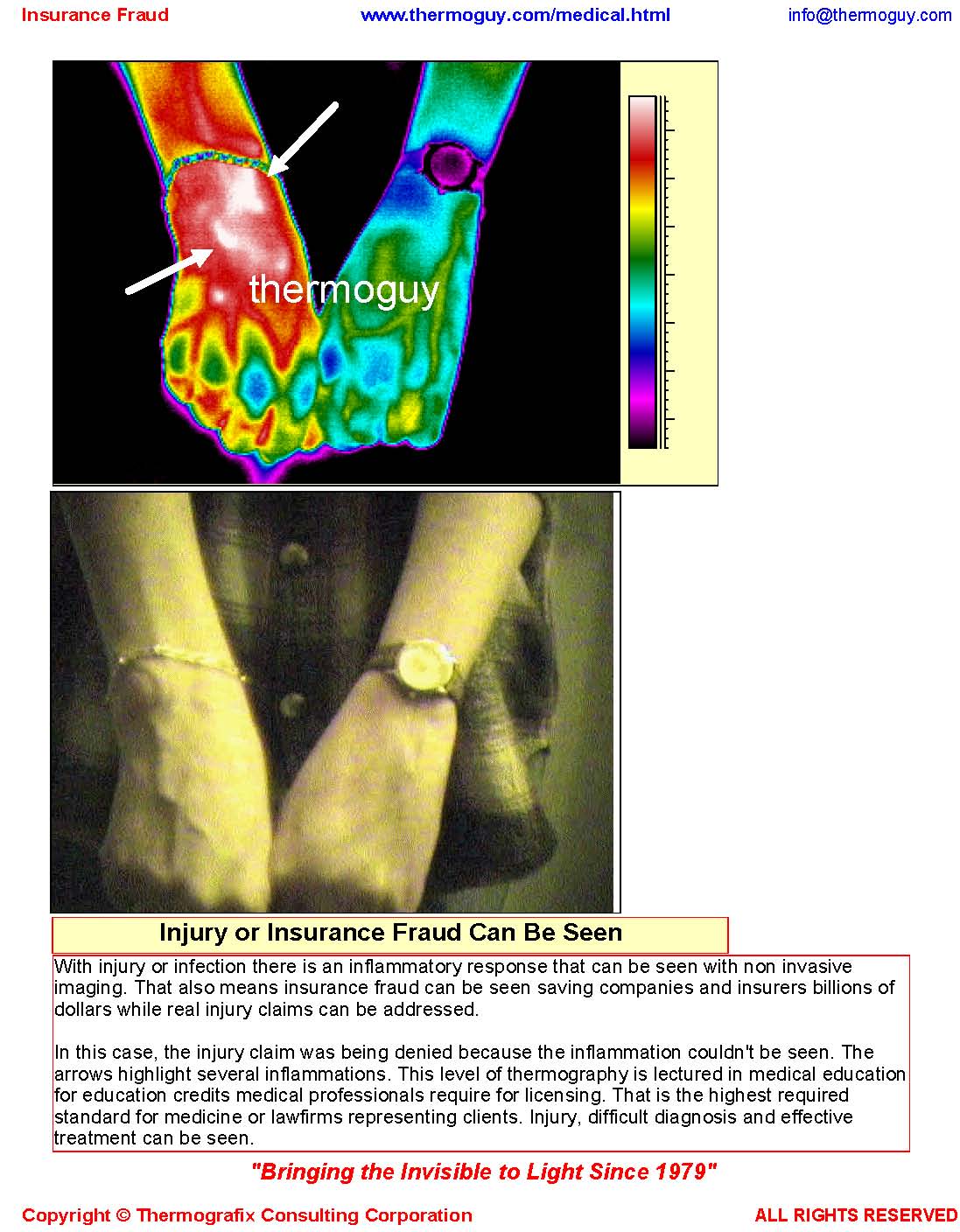 Workplace Injury or Insurance Fraud