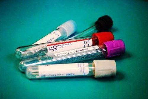 blood collection tubes